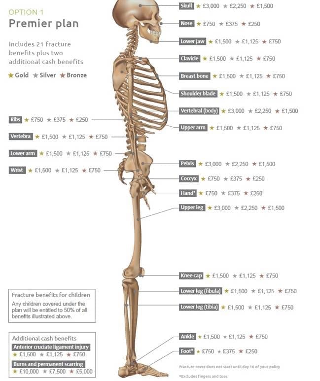 Sports Injury Bones